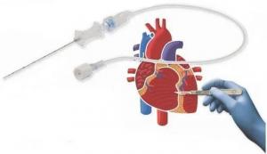 加快產(chǎn)學(xué)研用一體化發(fā)展  醫(yī)療器械發(fā)展迎來大好時(shí)機(jī)